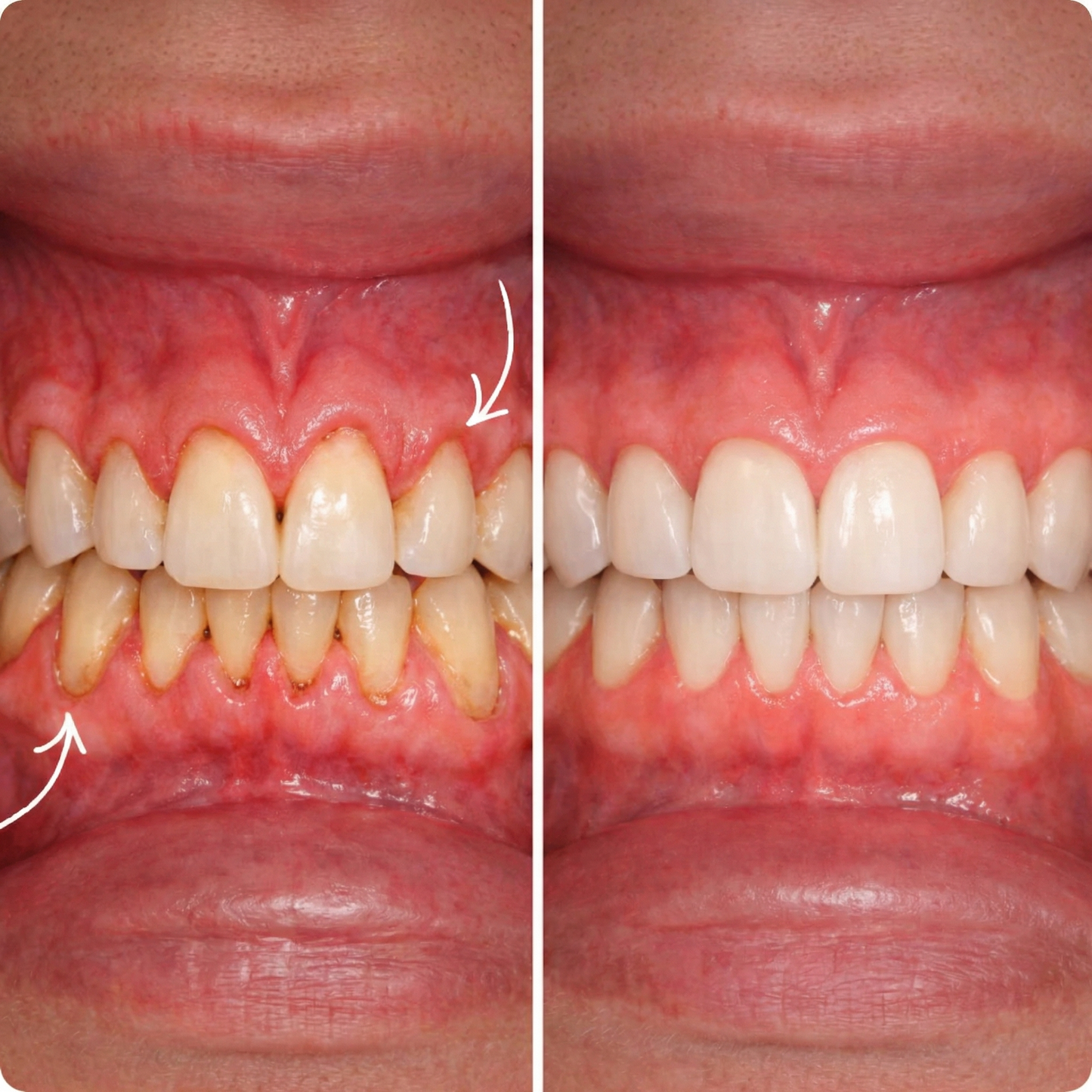 ClareCare™ Oral Defense for Gums