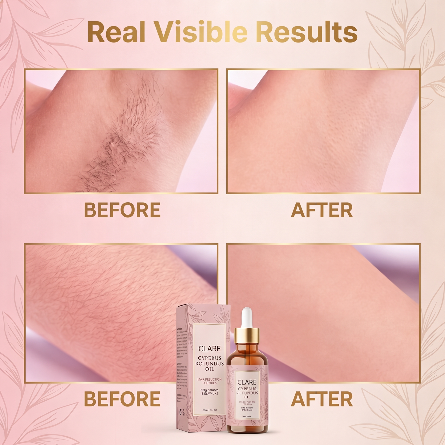 Cyperus Hair Reduction Oil