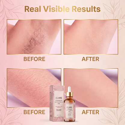 Cyperus Hair Reduction Oil